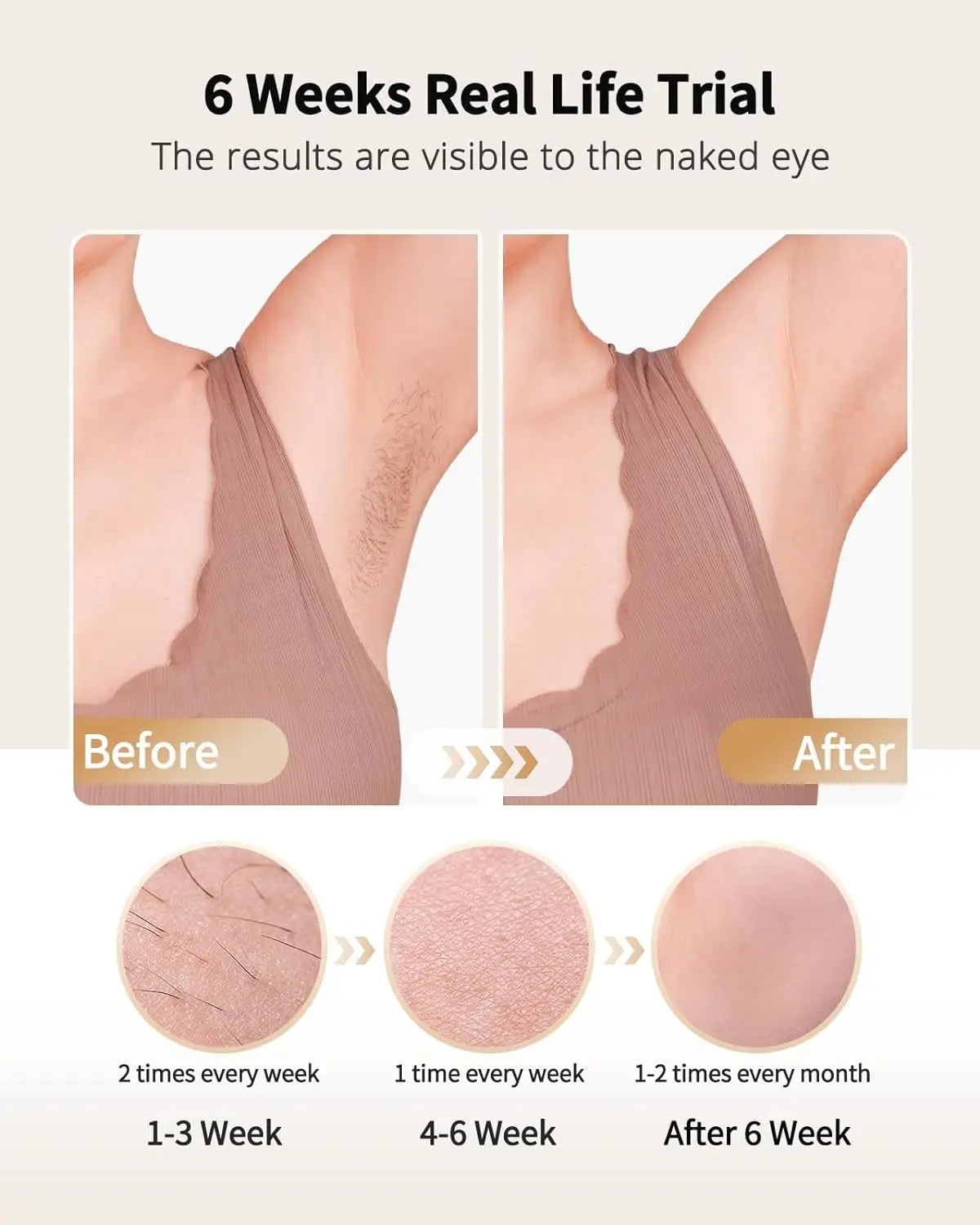 LYSMOSKI Laser Hair Removal Epilator Ice Cooling